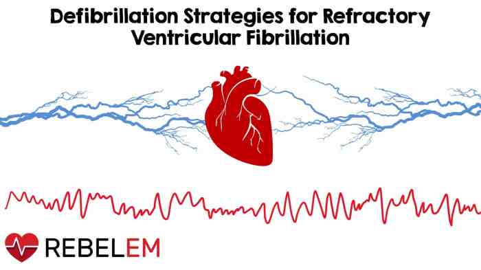 A patient was in refractory ventricular fibrillation. a third shock