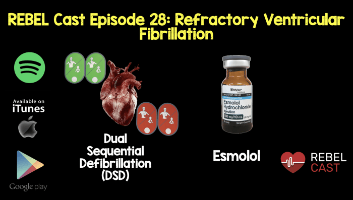 Ventricular fibrillation rhythm rhythms cardiac defibrillator